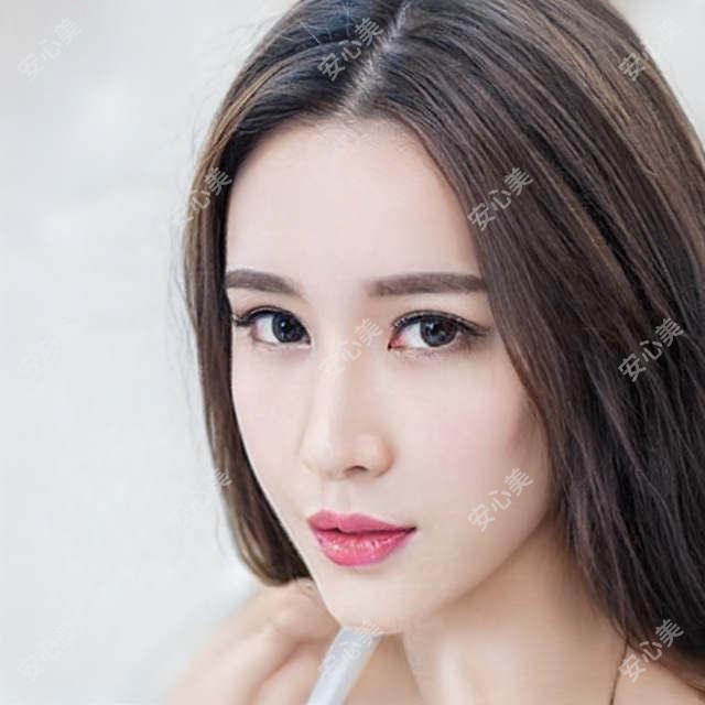 东莞蒜头鼻整形修复医生 | 排名前列的整形医院推荐