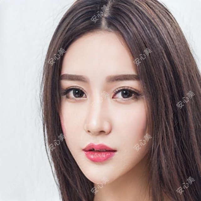 北京面部拉皮价格对比:蒂凡妮、漾格、等医院中面部拉皮手术费用一览表