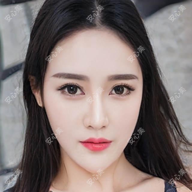 宁波2025美国强生眼力健新无极(Symfony)人工晶体价格表揭晓!(含美国爱尔康FNT00三焦点人工晶体/美国强生眼力健新无极(Symfony)人工晶体价格收费表)