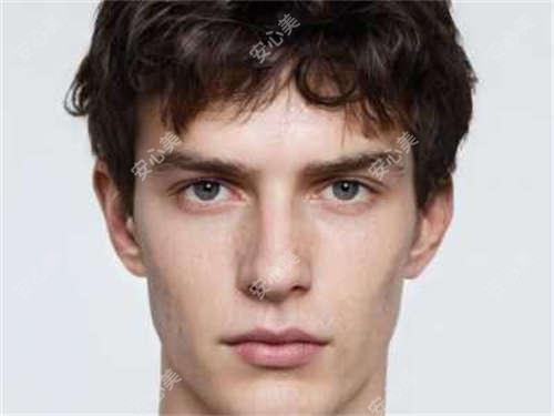 湛江M唇塑形9800元疗效能维持多久？术后需要恢复几天？