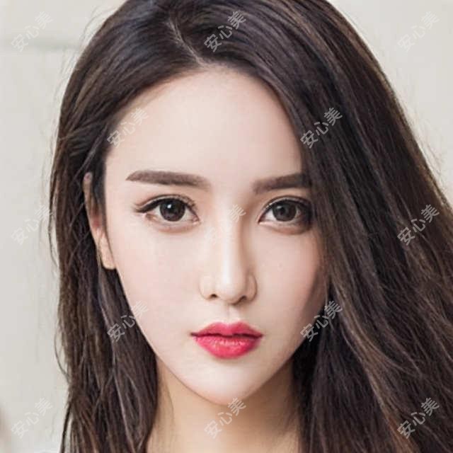 长沙嘟嘟唇和翘嘴唇有什么区别 嘟嘟唇项目价格及疗效对比