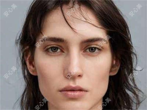 丰额头项目在徐州疗效如何、能维持多久？附2024年较新价格参考