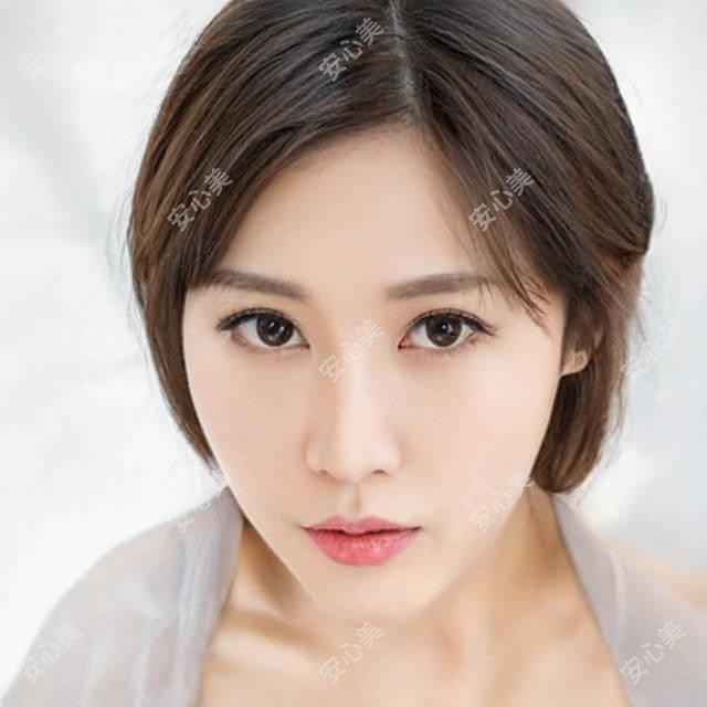 济南m22光子嫩肤价格解析 美国赛诺秀设备疗效与医院排名指南