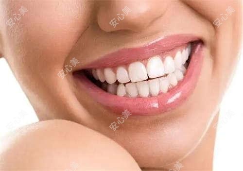 泰安玻尿酸填充卧蚕需要多少量 价格与疗效深度解析