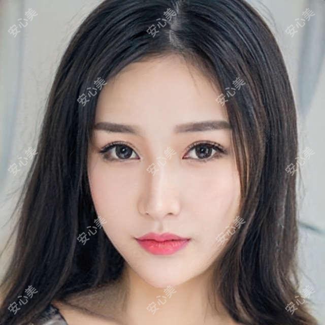 绍兴地区医美医院排行榜公开：上虞艺美 维美整形上榜，富贵包吸脂/面部微雕/脂肪填充价格表全解析！