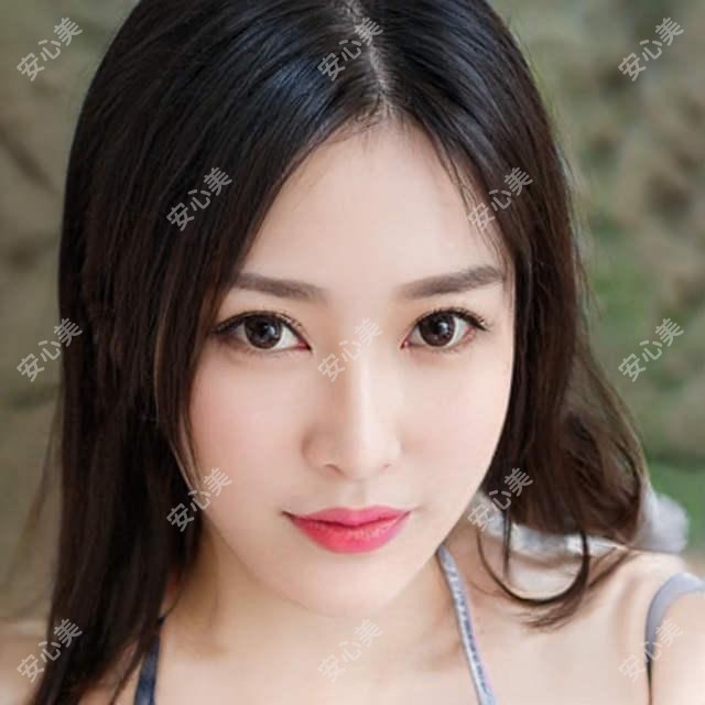 咸阳嘟嘟唇价格多少?这家咸阳口碑机构值得推荐:咸阳伊美尔医疗美容!