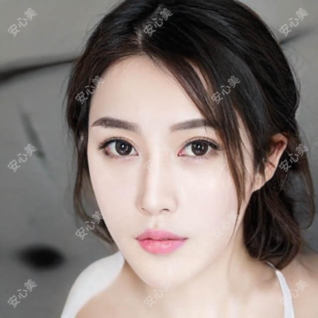 绵阳幼态脸整形价格多少 费用排名及项目介绍