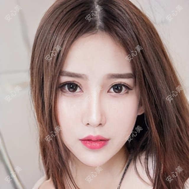 九江白内障超声乳化价格表预览,想变好看的小伙伴能参考