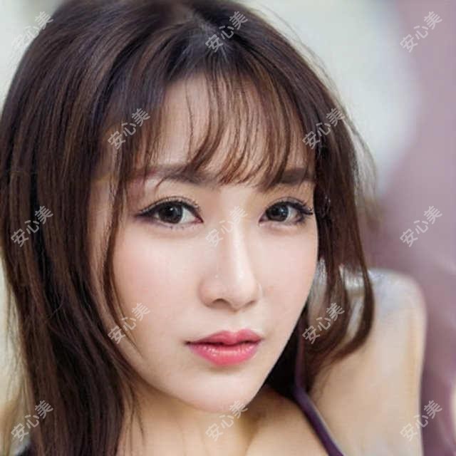 台州inmode黄金热拉提疗效如何、维持时间多长？附2023较新项目价目表