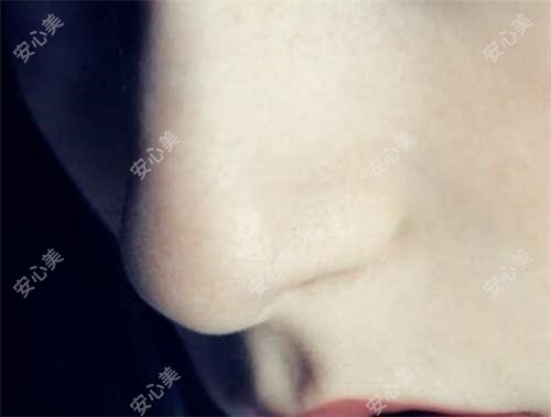 成都科健唯美眼科靠谱吗？近视手术9800元起，白内障手术12800元