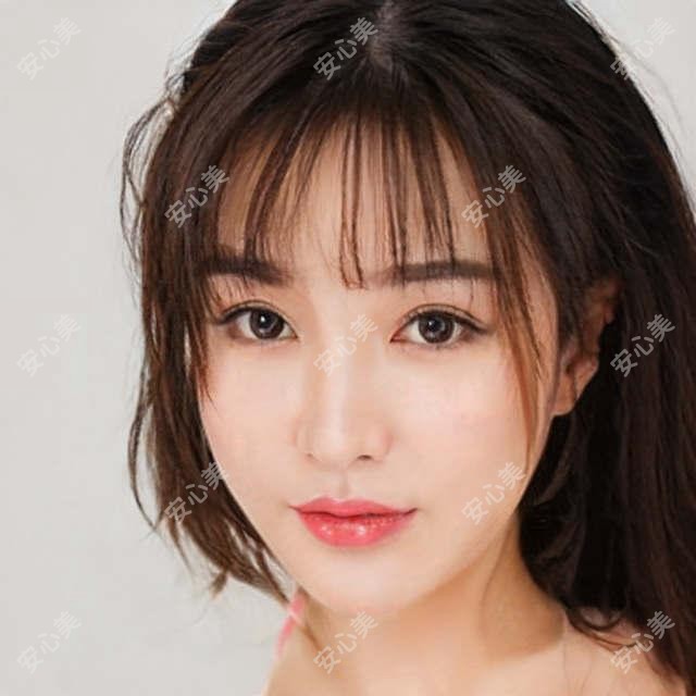 深圳自体脂肪填充脸颊价格多少钱？2025收费表：膨体填充面部10000元起、面部脂肪填充9200元起