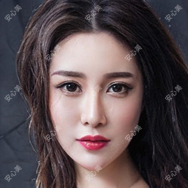 临沂肉欲唇项目价格多少?推荐临沂实力机构:临沂壹美天成医疗美容医院!