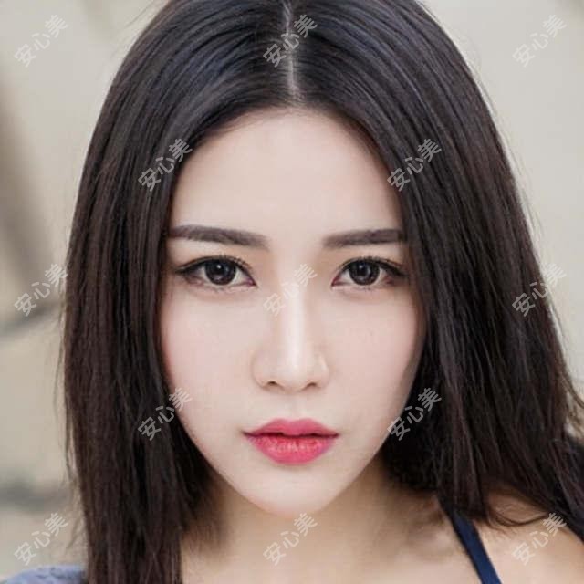 武汉同济生殖医院眼科靠谱吗?人工晶体植入术9800元,近视激光矫正12800元
