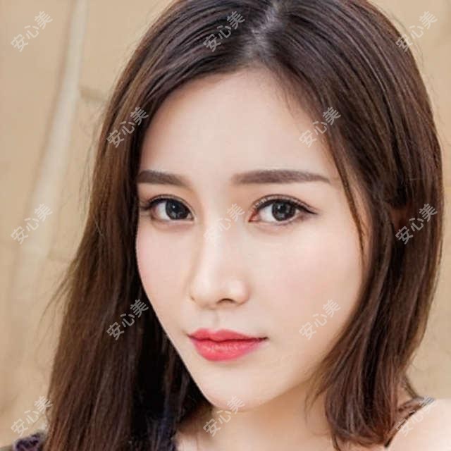 上海悦莱医美价格表出炉:双眼皮5800+隆鼻12800+光子嫩肤800起,性价比高