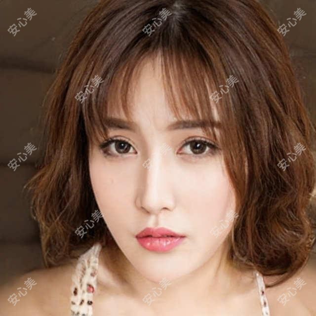 聊城眼周填充价格表大公开!附本地靠谱医院推荐