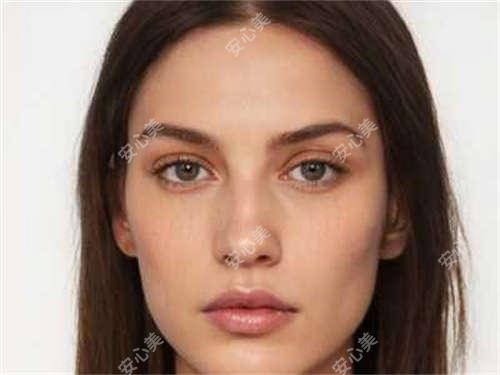 重庆玻尿酸丰唇多少钱?附价格表+靠谱医院推荐