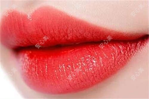 嘉兴微笑唇和嘟嘟唇哪个更好看？价格与疗效排名对比