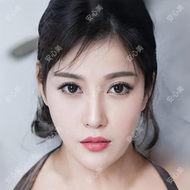 烟台黄金超光子一次多少钱?疗效能维持多久?