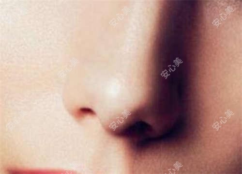 枣庄热拉提与超塑区别解析 价格疗效排名对比指南