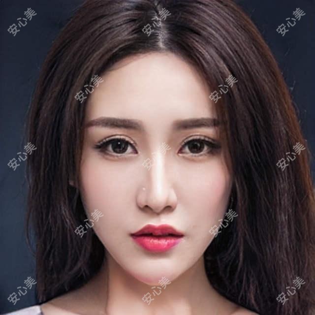 深圳眼科医院排行榜:龙翔、龙济、宝田医院近视激光与白内障手术哪家强?