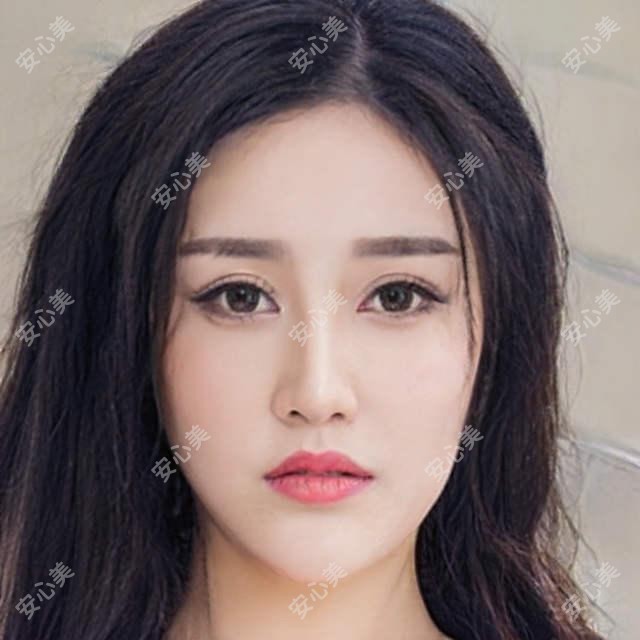 深圳联合会美&鹏程整形:双眼皮、隆鼻、吸脂项目全解析