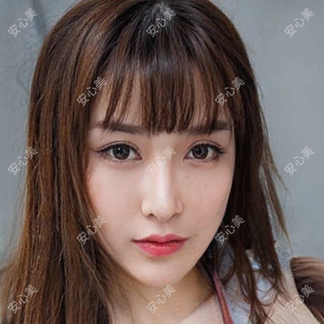 北京广济疤痕科vs丽星翼美:祛疤、点阵激光、玻尿酸填充,哪家更值得选?