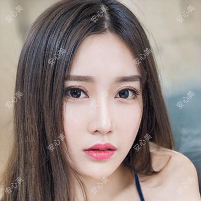 天津玻尿酸丰唇价格表&医院推荐！亲测避坑指南
