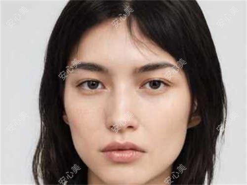 温州幼态脸项目多少钱?9800元打造自然减龄感,怕痛星人也能轻松get!