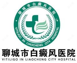 聊城市白癜风