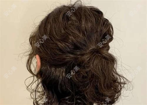 成都半长期纹唇哪家好?推荐成都半长期纹唇口碑好还正规的医院