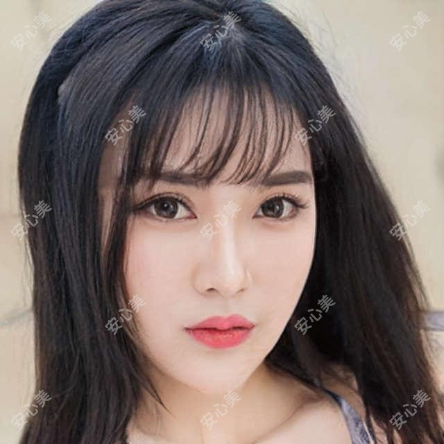 盐城AOPT超光子嫩肤价格表预览,想变好看的小伙伴能够参照