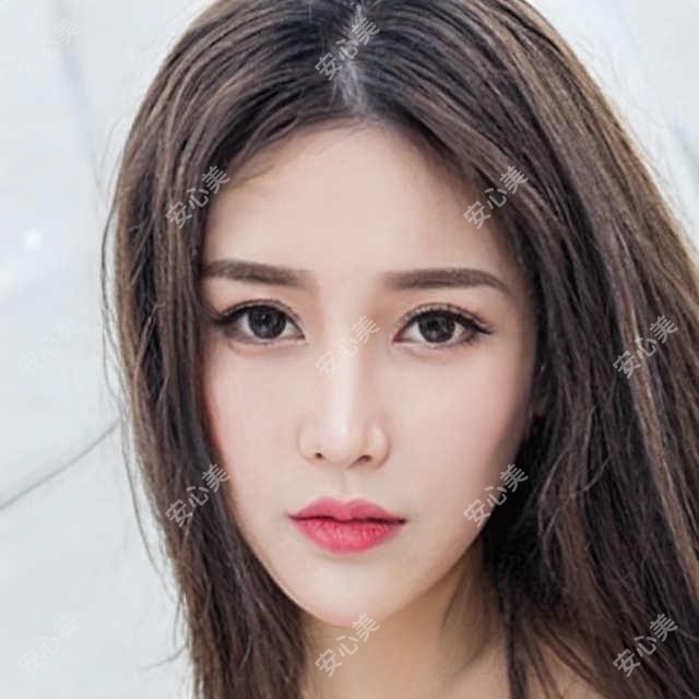 枣庄嘟嘟唇价格表&医院推荐，看完再决定！