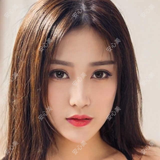 临沂德国蔡司smile3.0全飞秒激光价目表:临沂德国蔡司smile3.0全飞秒激光市场均价及各医院报价参考