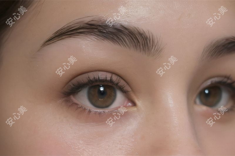 大理伊美东方丽人整形是正规的