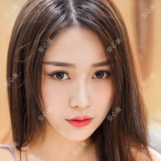 成都美容整形医院厚唇改薄多少钱?厚唇改薄2880+|M唇3680+|嘴角上扬2980+