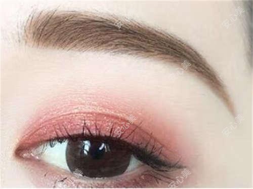 菏泽玻尿酸丰唇价格参考,注射费用与疗效排名分析