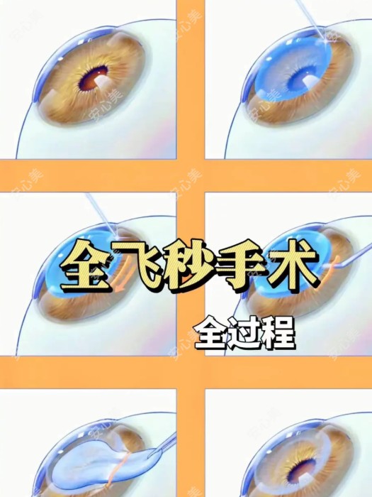 温州眼视光眼科医院全飞秒手术为什么值得选 温州眼视光眼科医院全飞秒手术为什么值得选