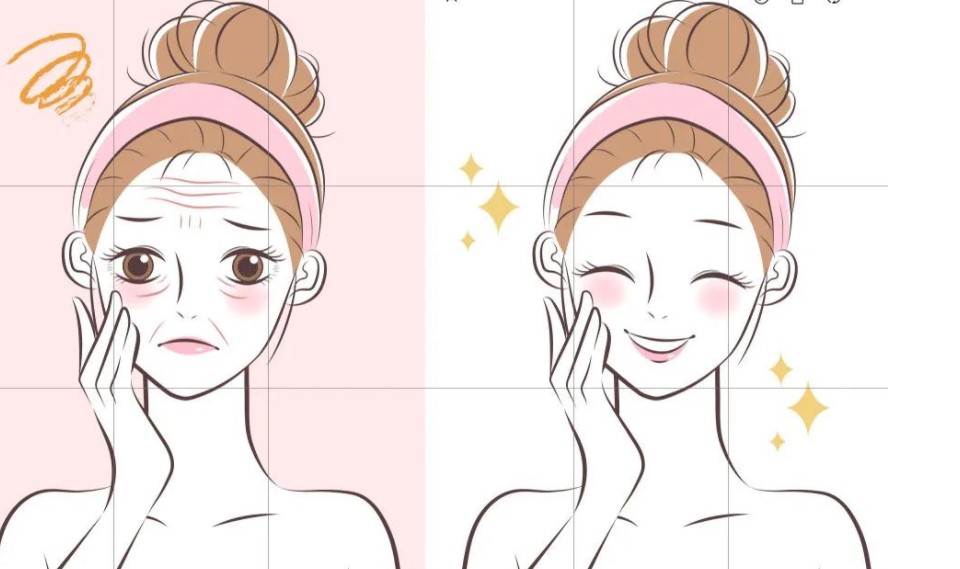 王易彬钻石网面部提升实际实例