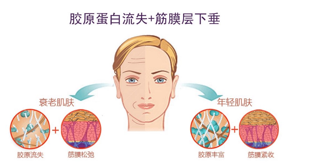 王易彬钻石网面部提升的评价好