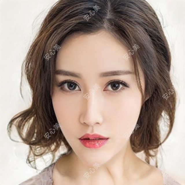 种植胡须怎么治疗(种植胡须治疗价格贵吗)