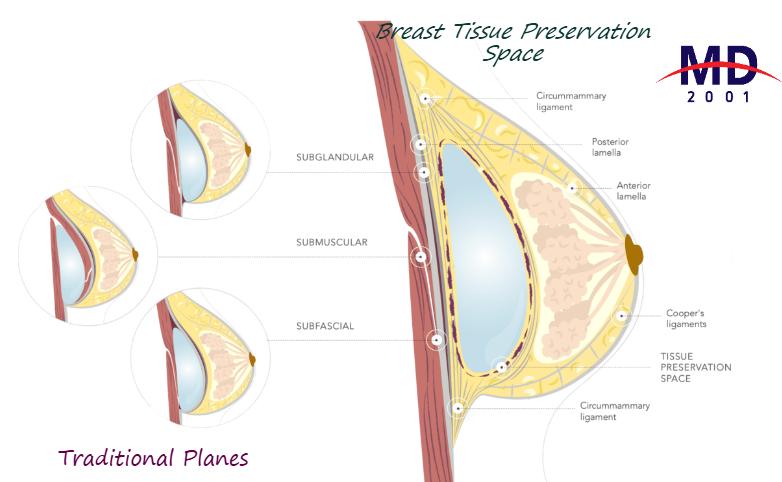 杭州胸部异物取出就诊攻略