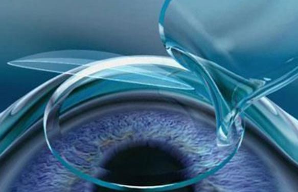 滨州沪滨爱尔眼科医院用户高频问题解答