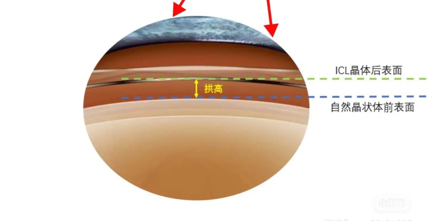 北京王红眼科医生预约挂号亲测有效方式