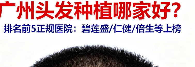 广州头发种植哪家好