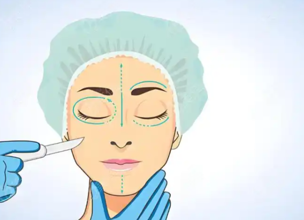 孔怀川医生双眼皮修复的收费