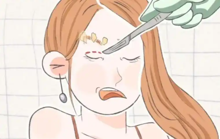 选择专门医生是双眼皮修复的关键