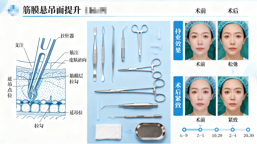 西宁市第二人民医院整形美容科面部提升特色