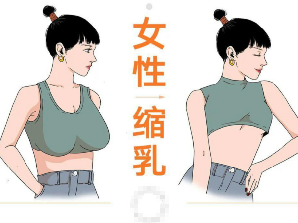 河南整形医生赵绛波缩胸费用详细解析