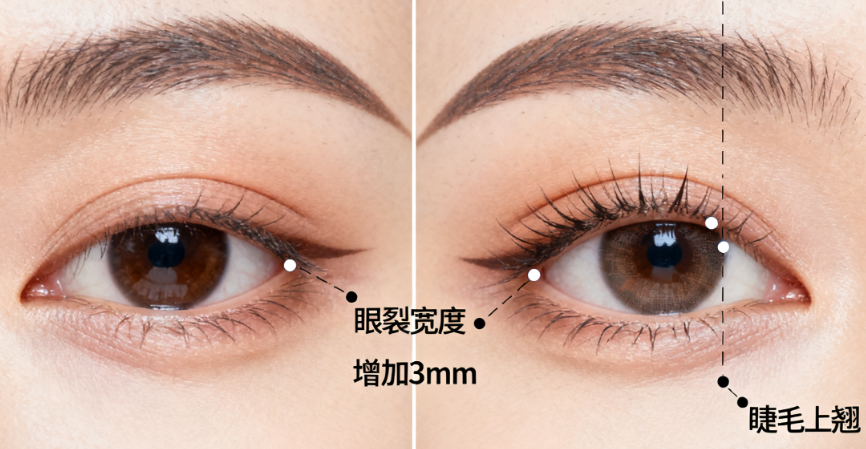 二、刘静杰医生与北京其他九大双眼皮医生对比