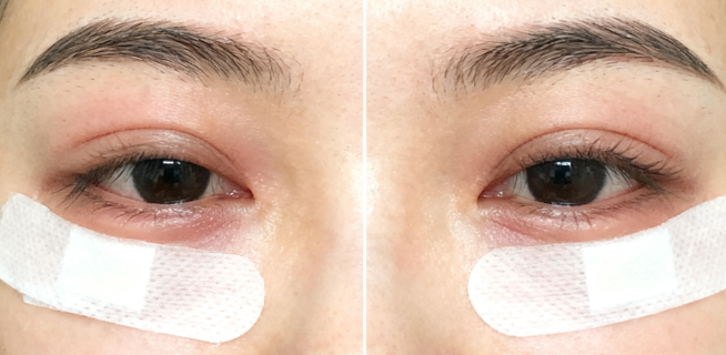 二、整形医生粟娜预约流程与就诊攻略